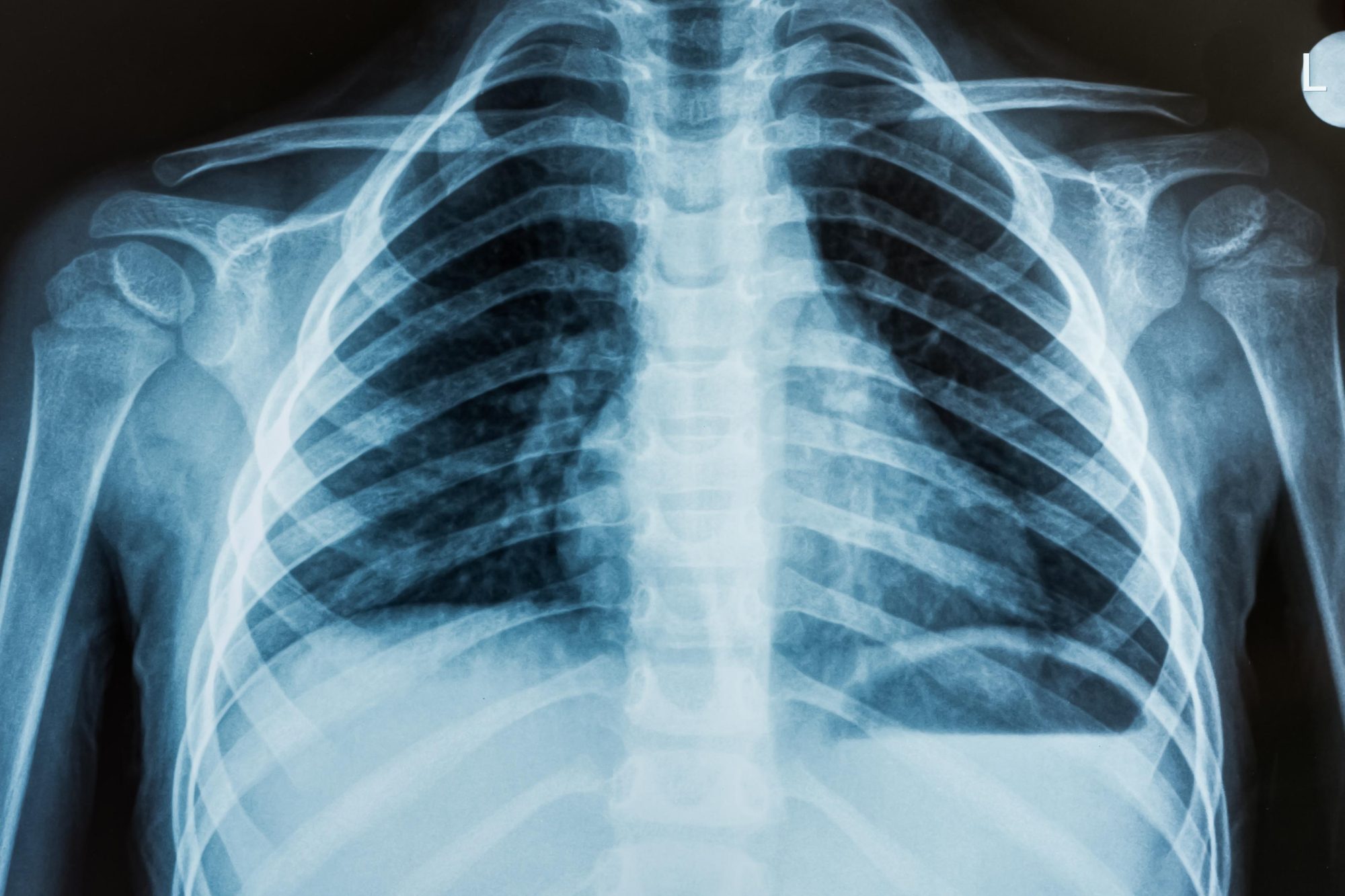 Medical Imaging
